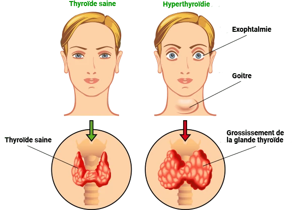 Illustration de la glande thyroïde, cœur de notre vitalité